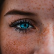 Skin Warnings Your Freckles are Hiding