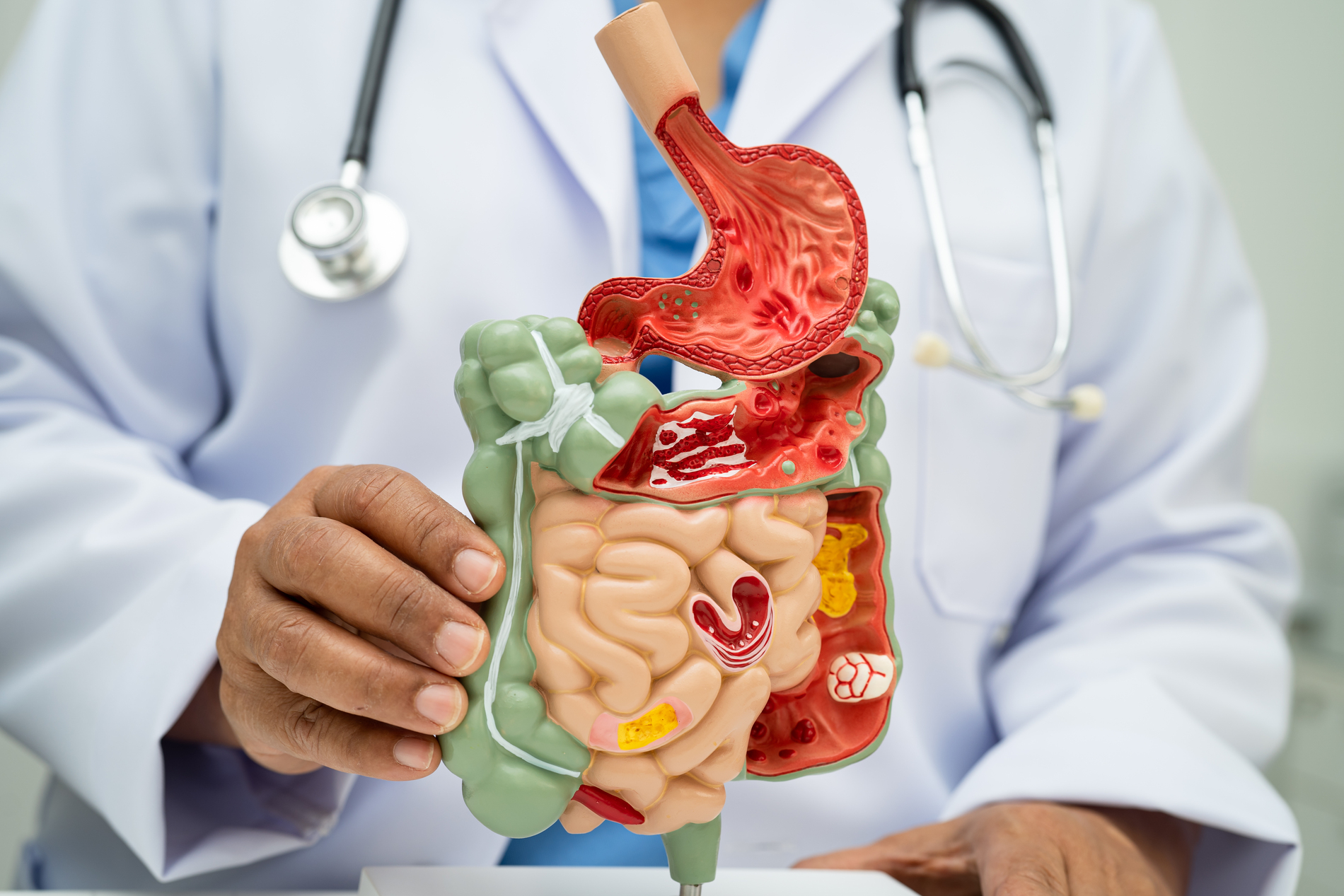 Digestive Troubles