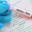 Is It Time to Check Your Blood Sugar? 10 Signs You Might Need an HbA1c Test