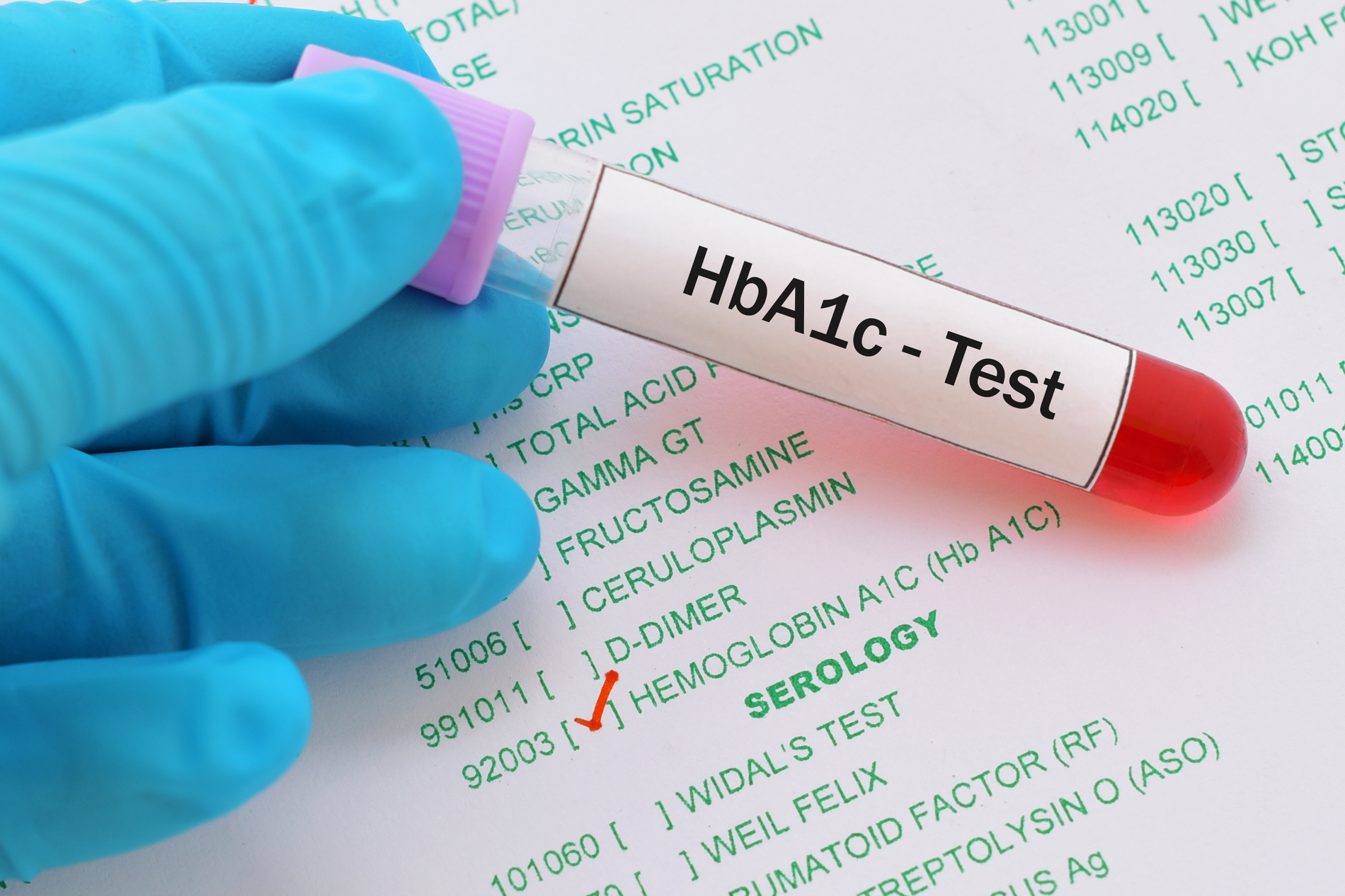 Is It Time to Check Your Blood Sugar? 10 Signs You Might Need an HbA1c Test