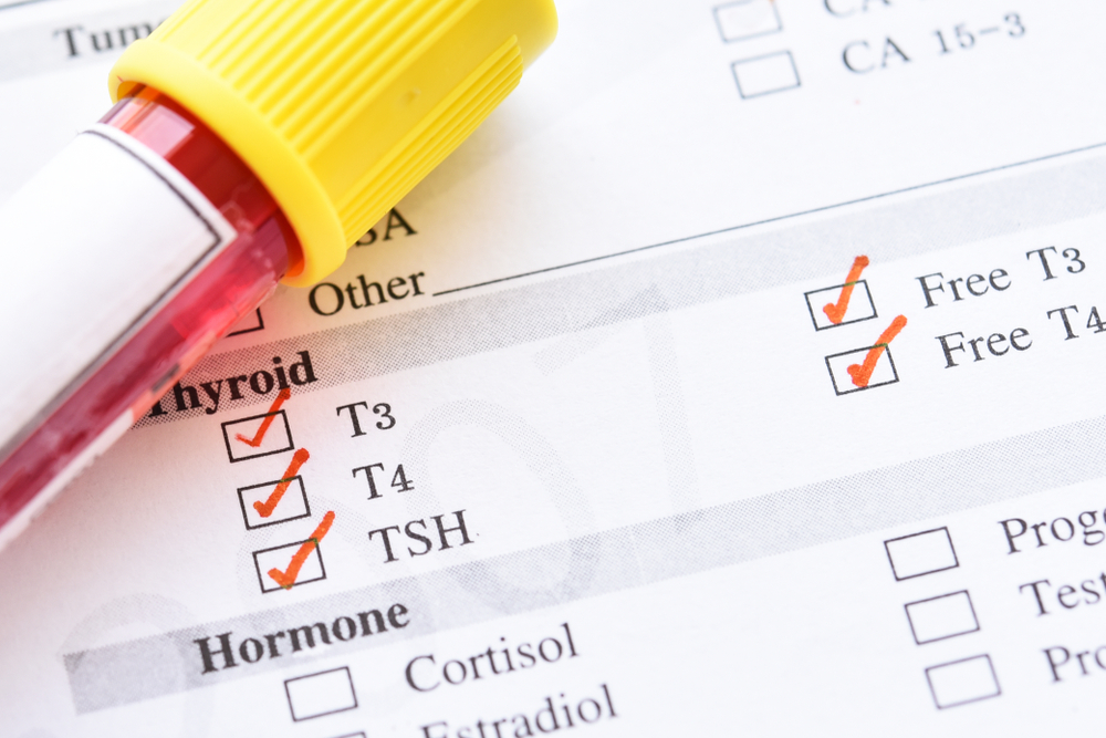 Thyroid Function Tests (TSH ± Free T3/T4)