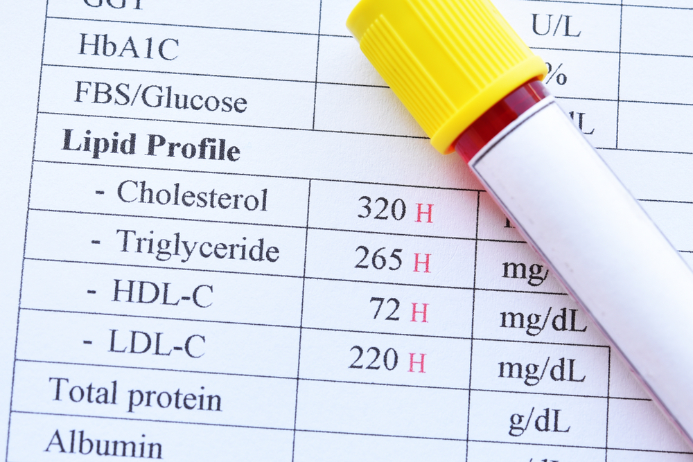 Lipid Profile (Cholesterol Panel)