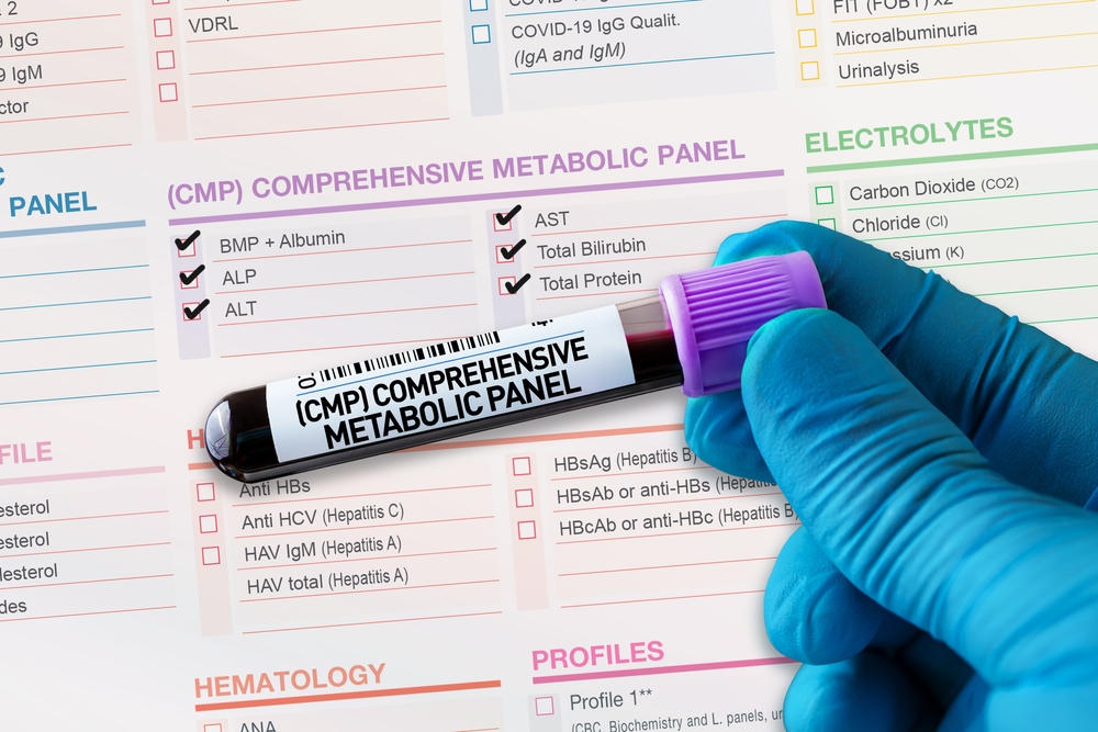 Comprehensive Metabolic Panel (CMP)