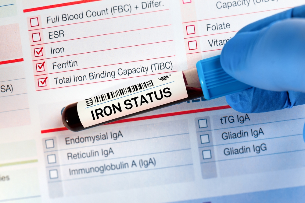 Iron Studies (Ferritin, Iron, TIBC)