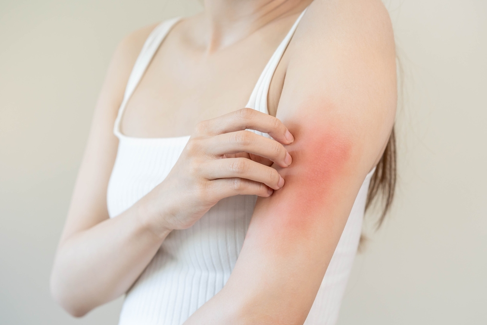 Dry, Itchy Skin