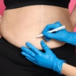 10 Secrets No One Tells You About Weight Loss Surgery