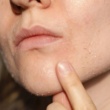 13 Hacks to Nurture Dry Skin