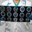 Top 11 Foods That Reduce the Risk of Having a Stroke