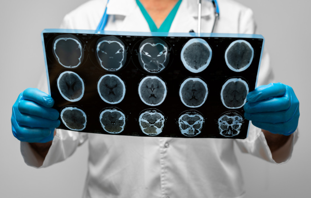 Brain scan