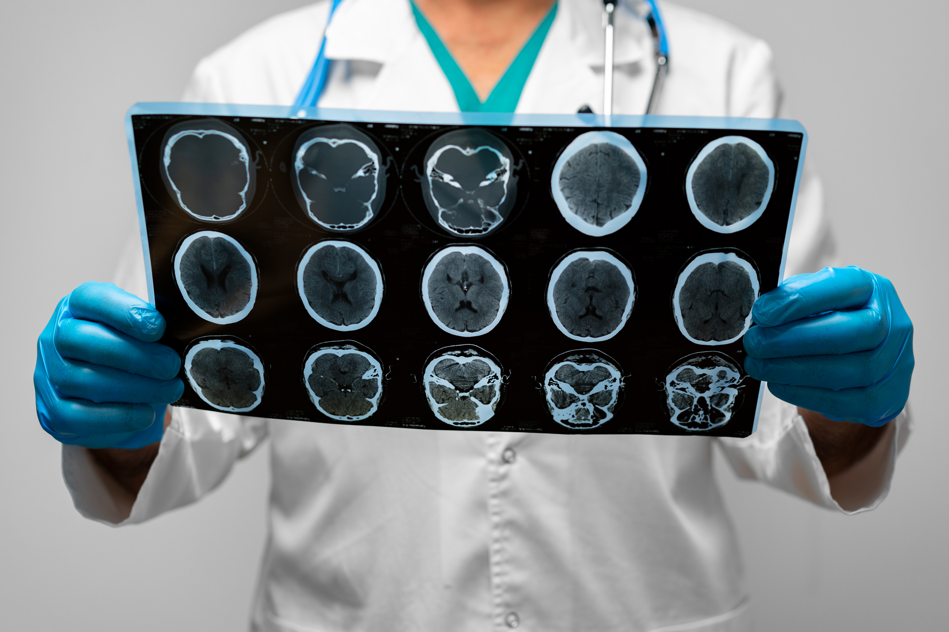 Brain scan