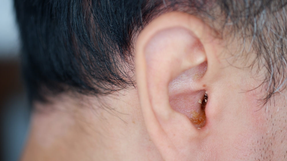 Ear Infections