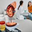 These 11 Foods Help Patients with Kidney Stones