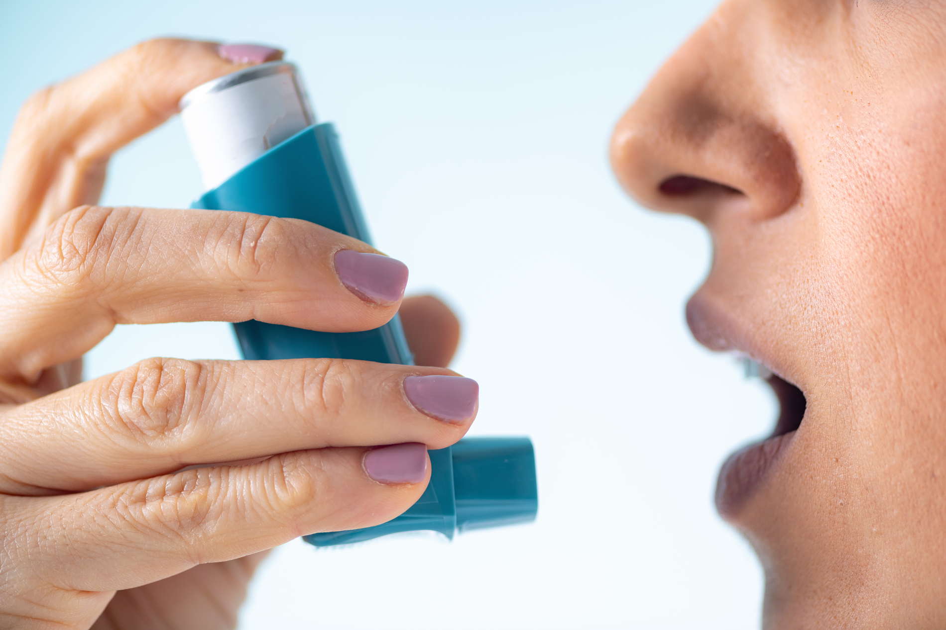 12 Everyday Things That Can Trigger Allergic Asthma