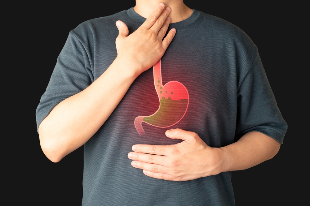 Acid Reflux (GERD)