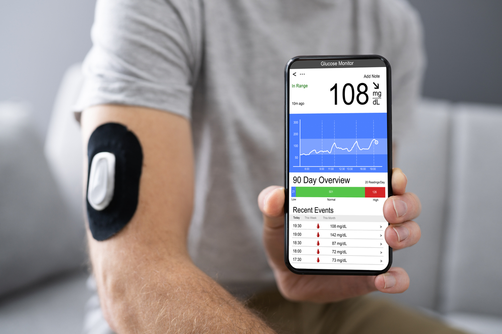 Use a Continuous Glucose Monitor (CGM)